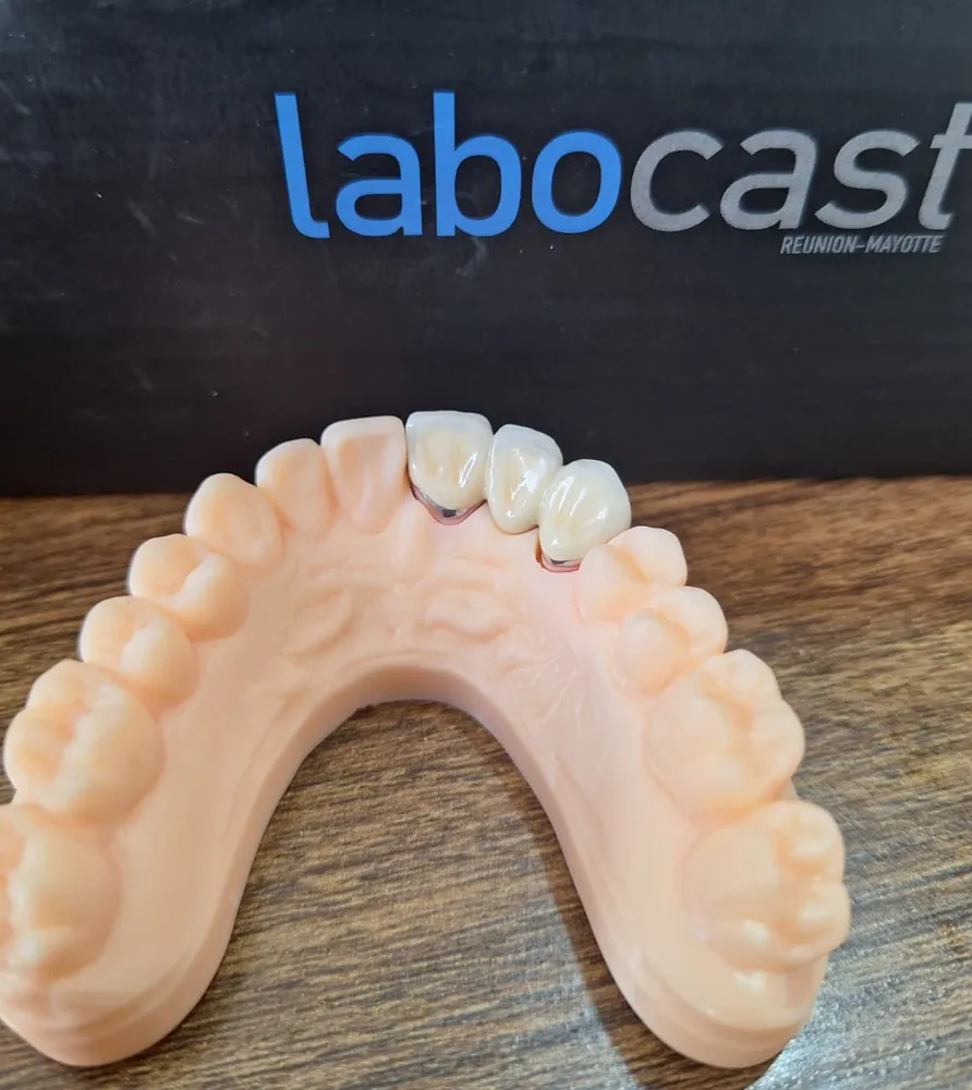 Partial denture seen from the side